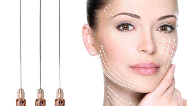 Botox-PDO-Threadlift-0 Botox-PDO-Threadlift-0