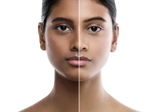 Skin-Lightening Skin-Lightening